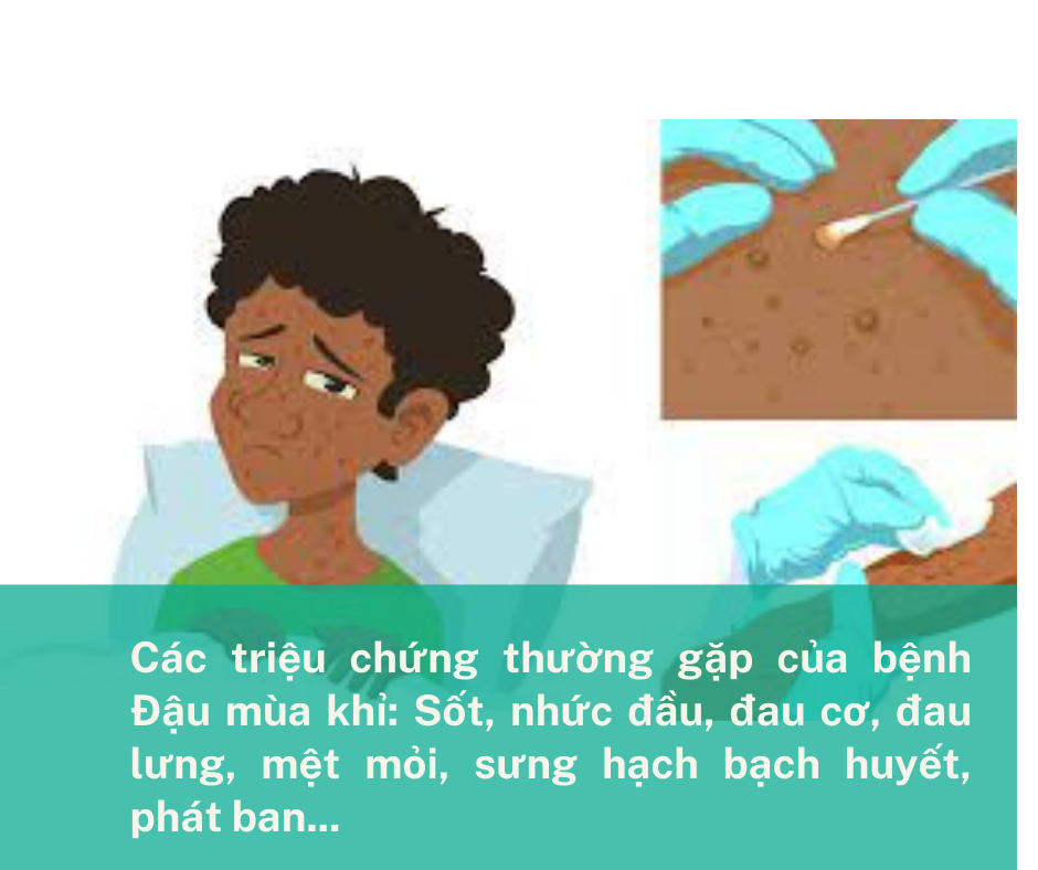 Hỏi đáp về bệnh đậu mùa khỉ (Phần 1)